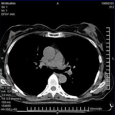 2008 03 31 13 50 16 706