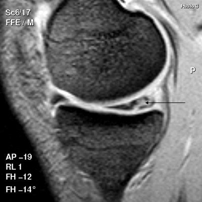 2008 04 02 15 06 14 706