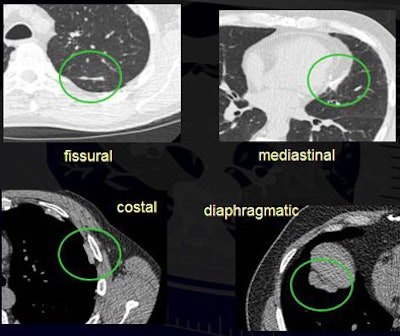 2008 04 02 15 52 37 706