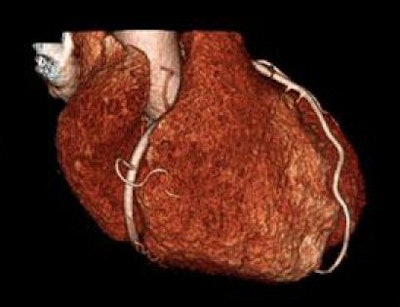 2008 04 04 14 16 39 706