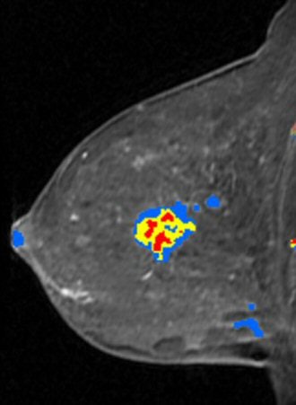 2008 04 08 10 51 21 706