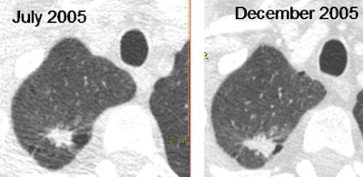 2008 04 08 16 24 45 706