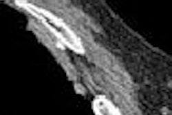 2008 04 09 09 52 45 706