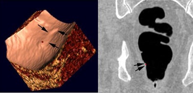 2008 04 15 11 13 56 706