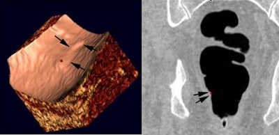 2008 04 15 11 13 56 706