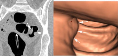 2008 04 15 11 15 36 706