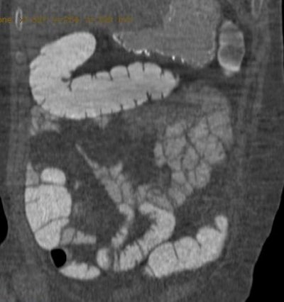 2008 04 15 15 23 03 706