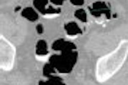 2008 04 15 15 23 28 706