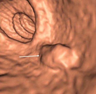 2008 04 16 14 42 56 706