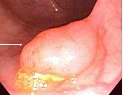 2008 04 16 14 43 10 706