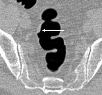 2008 04 16 14 43 27 706