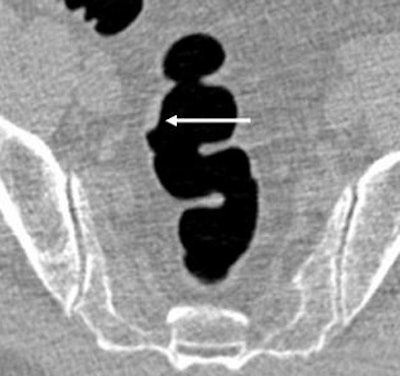 2008 04 16 14 43 27 706