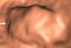 2008 04 16 14 44 30 706