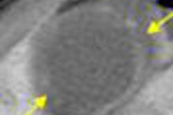 2008 04 22 16 44 00 706