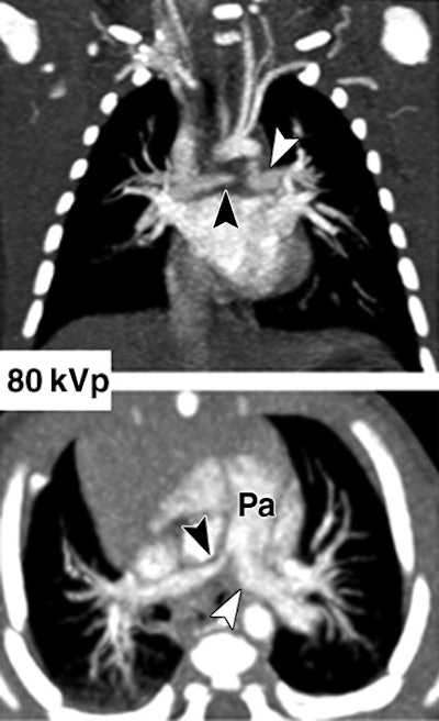 2008 05 20 15 45 14 706