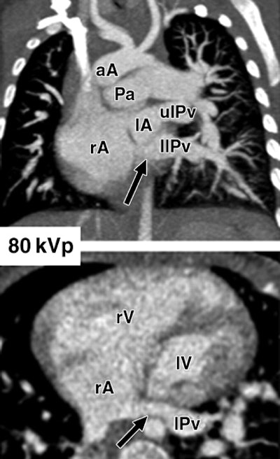 2008 05 20 15 45 28 706
