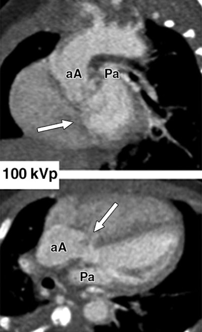 2008 05 20 15 45 44 706