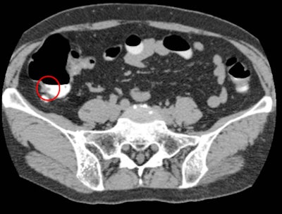 2008 05 30 14 41 01 706