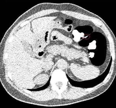 2008 05 30 15 13 07 706