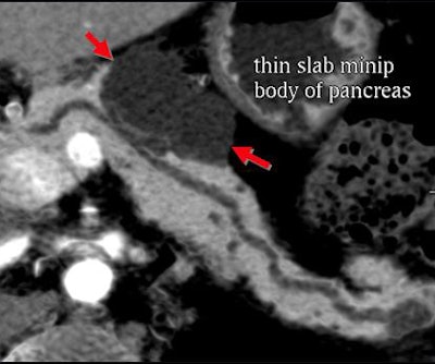 2008 06 03 17 27 46 706