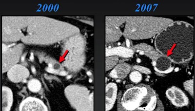 2008 06 03 17 29 14 706