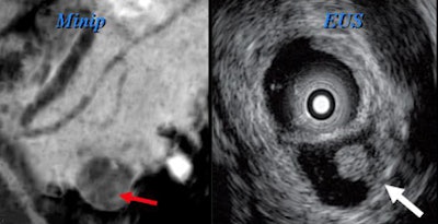 2008 06 03 17 30 50 706