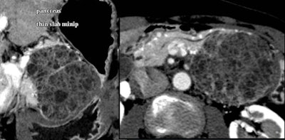 2008 06 03 17 32 49 706