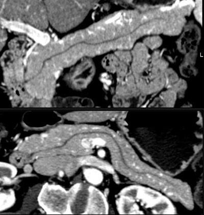 2008 06 03 17 35 40 706