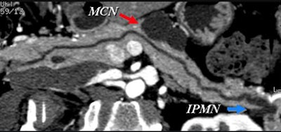 2008 06 03 17 36 55 706