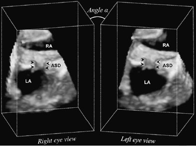 2008 06 09 09 43 42 504 Vasiliyev twoviews