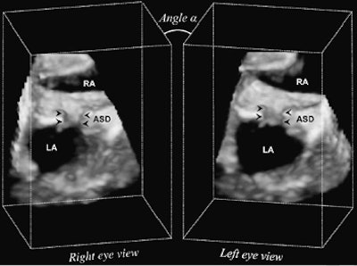 2008 06 09 09 43 42 504 Vasiliyev twoviews