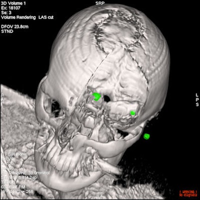 2008 06 16 14 19 48 301 Fanti Image Of The Year 2 Resized