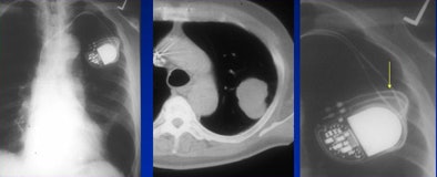 2008 06 20 10 59 48 45 White satisfaction of search