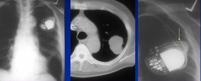 2008 06 20 10 59 48 45 White satisfaction of search