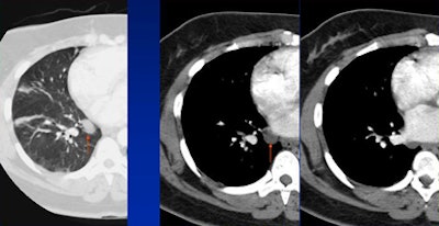 2008 06 20 10 59 51 734 White loculated