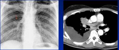 2008 06 20 10 59 56 576 White decision Making