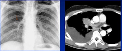 2008 06 20 10 59 56 576 White decision Making