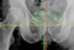 2008 06 26 13 23 12 63 Obi Thumb