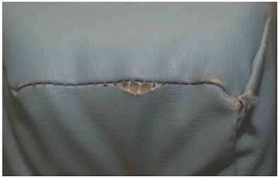 2008 06 26 14 27 52 408 2008 06 Xx Mri Infection4