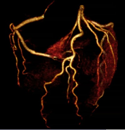 2008 06 27 12 48 23 460 Wang top 3d jpg