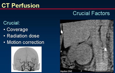 2008 06 30 11 22 14 888 Prokop perfusion