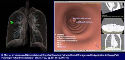 2008 07 01 13 09 37 62 Mori nav2lungnodules