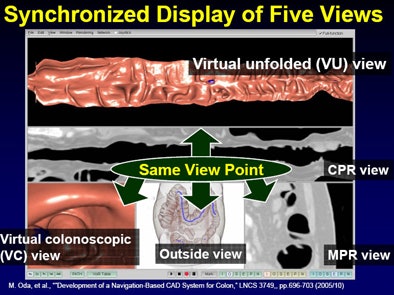 2008 07 01 13 09 42 349 Mori fivesynchonized Vc