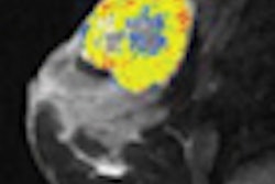 2008 07 01 14 15 18 817 2008 07 02 Ser Thumb