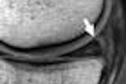 2008 07 07 12 57 34 760 07 07 3034 02a Thumb
