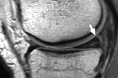 2008 07 07 12 57 36 649 07 07 3034 02a Resized