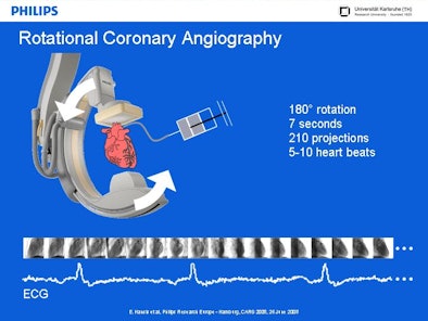 2008 07 09 10 31 09 179 Hansis rotationalangio Resized
