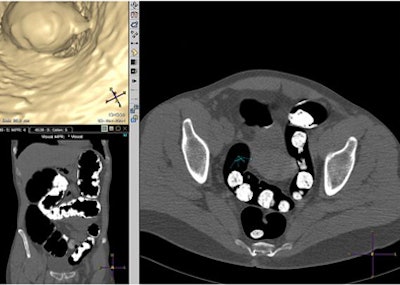 2008 07 15 13 24 00 512 Jensch figb1