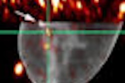 2008 07 30 09 38 17 42 Madhav Duke Aapm2008 Hybrid Patient Thumb