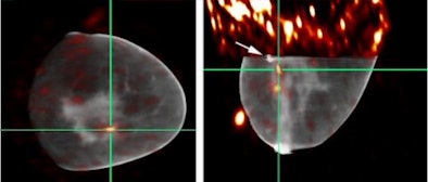 2008 07 30 09 38 19 118 Madhav Duke Aapm2008 Hybrid Patient Res